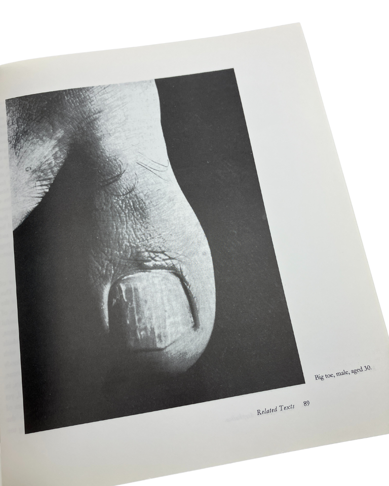 encyclopaedia acephalica